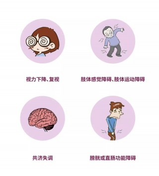捷灵亚(捷灵亚芬戈莫德)